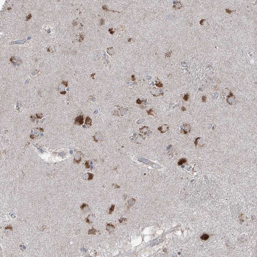 Immunohistochemical staining of human caudate shows strong cytoplasmic positivity in neuronal cells.