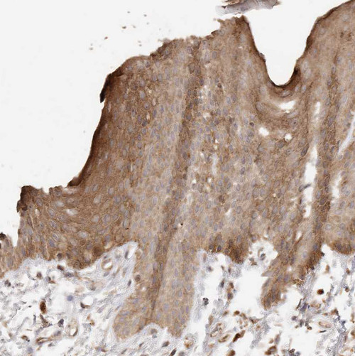 Immunohistochemical staining of human Skin shows moderate cytoplasmic positivity in squamous epithelial cells.