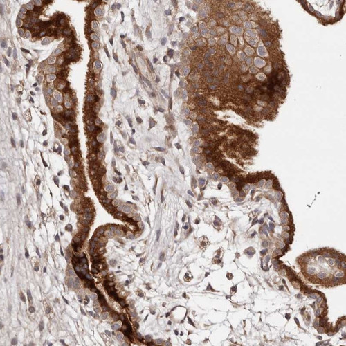 Immunohistochemical staining of human placenta shows cytoplasmic positivity in trophoblastic cells.