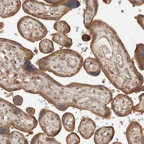 Immunohistochemical staining of human placenta shows cytoplasmic positivity in trophoblastic cells.