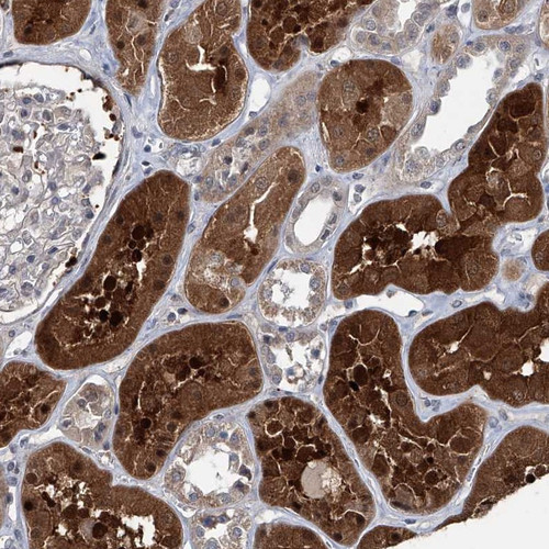 Immunohistochemical staining of human kidney shows strong cytoplasmic and nuclear positivity in cells of tubules.