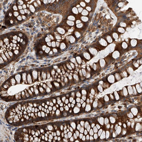 Immunohistochemical staining of human colon shows strong cytoplasmic positivity in glandular cells.