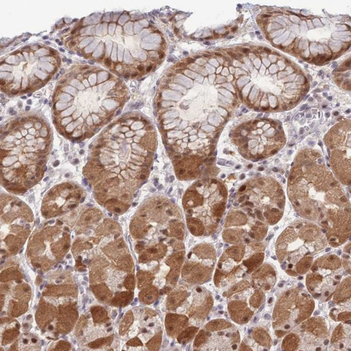 Immunohistochemical staining of human stomach, lower shows strong cytoplasmic and nuclear positivity in glandular cells.