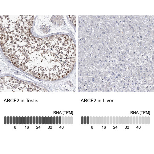 Immunohistochemistry analysis in human testis and liver tissues using Anti-ABCF2 antibody. Corresponding ABCF2 RNA-seq data are presented for the same tissues.