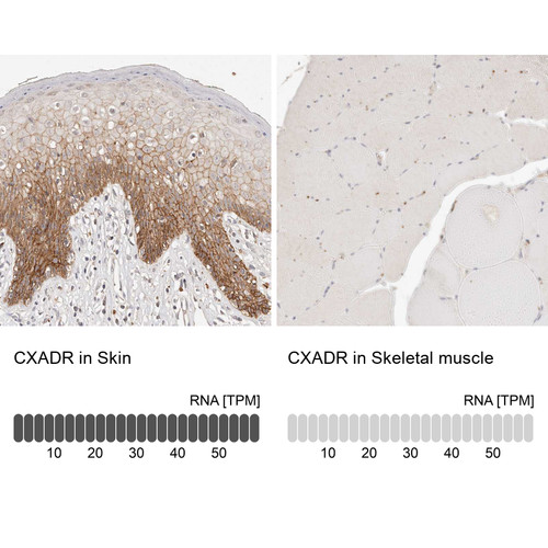 Immunohistochemistry analysis in human skin and skeletal muscle tissues using HPA030411 antibody. Corresponding CXADR RNA-seq data are presented for the same tissues.