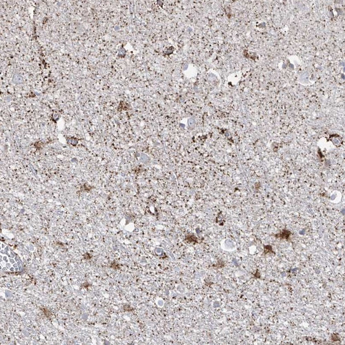 Immunohistochemical staining of human cerebral cortex shows distinct cytoplasmic positivity in subsets of glial cells.