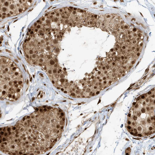 Immunohistochemical staining of human testis shows strong nuclear positivity in cells in seminiferous ducts.