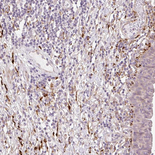 Immunohistochemical staining of human urinary bladder shows distinct positivity positivity in connective tissue.