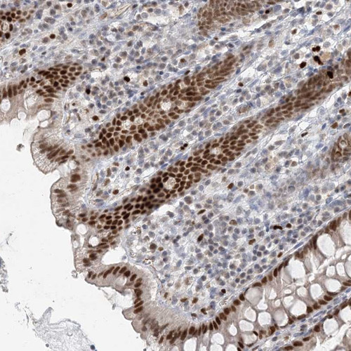 Immunohistochemical staining of human colon shows strong nuclear positivity in glandular cells.
