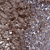 Immunohistochemical staining of human liver shows strong cytoplasmic and extracellular positivity.