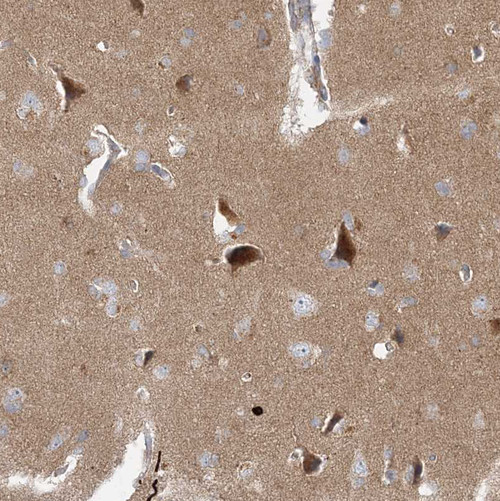 Immunohistochemical staining of human Cerebral cortex shows strong cytoplasmic positivity in neuronal cells.