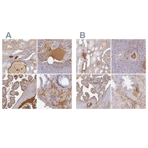 Immunohistochemical staining of human kidney, pancreas, placenta and prostate using Anti-ALB antibody HPA031024 (A) shows similar protein distribution across tissues to independent antibody HPA031025 (B).