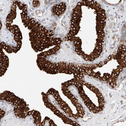 Immunohistochemical staining of human prostate shows strong membranous positivity in glandular cells.