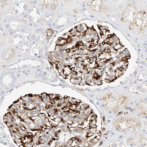 Immunohistochemical staining of human kidney shows distinct membrane positivity in renal glomeruli.