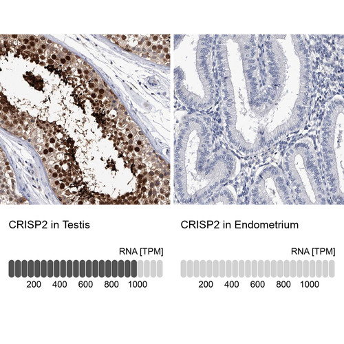 Immunohistochemistry analysis in human testis and endometrium tissues using Anti-CRISP2 antibody. Corresponding CRISP2 RNA-seq data are presented for the same tissues.