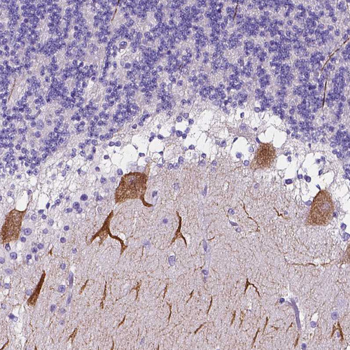 Immunohistochemical staining of human cerebellum shows strong granular cytoplasmic positivity in Purkinje cells.