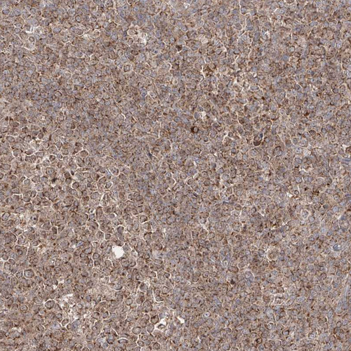 Immunohistochemical staining of human tonsil shows strong cytoplasmic positivity in non-germinal center cells.