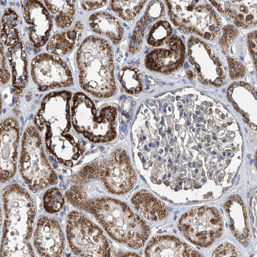 Immunohistochemical staining of human kidney shows strong granular cytoplasmic positivity in cells in tubules.