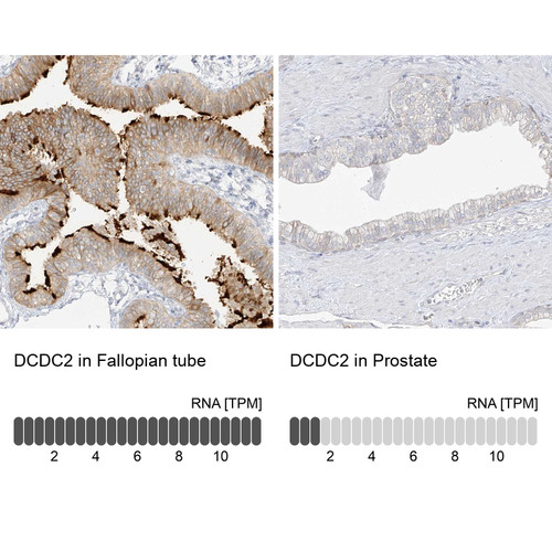 Immunohistochemistry analysis in human fallopian tube and prostate tissues using Anti-DCDC2 antibody. Corresponding DCDC2 RNA-seq data are presented for the same tissues.