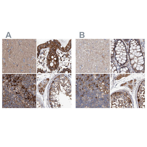 Immunohistochemical staining of human cerebral cortex, colon, lymph node and testis using Anti-ASCC3 antibody HPA031610 (A) shows similar protein distribution across tissues to independent antibody HPA031608 (B).