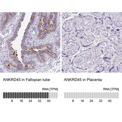 Immunohistochemistry analysis in human fallopian tube and placenta tissues using Anti-ANKRD45 antibody. Corresponding ANKRD45 RNA-seq data are presented for the same tissues.