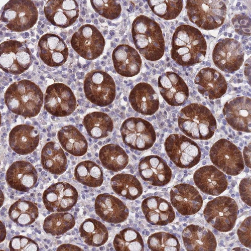 Immunohistochemical staining of human duodenum shows strong cytoplasmic and nuclear positivity in glandular cells.