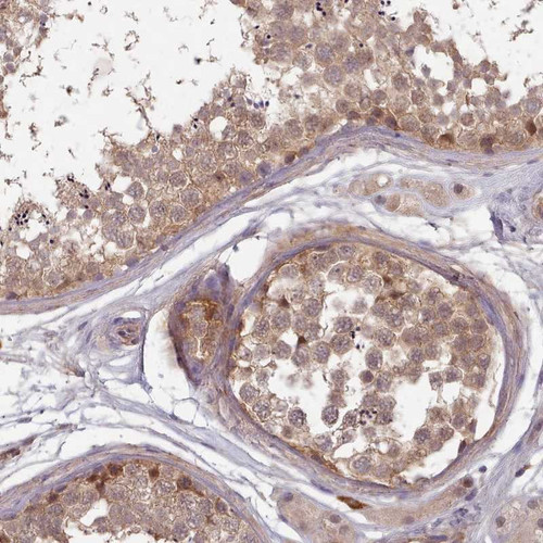Immunohistochemical staining of human testis shows moderate cytoplasmic and nuclear positivity in cells in seminiferus ducts.