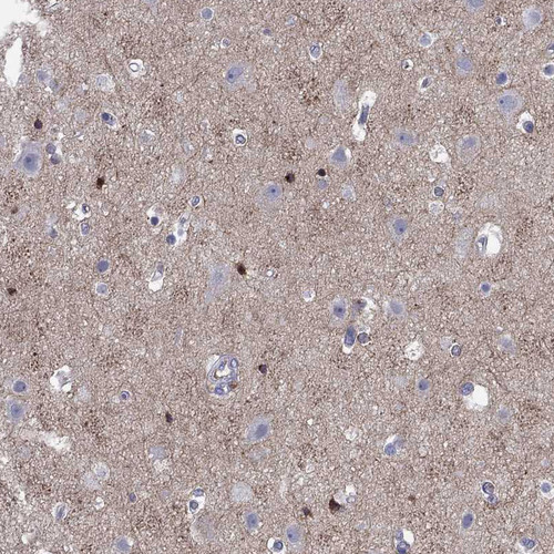 Immunohistochemistry analysis in human cerebral cortex and pancreas tissues using Anti-CNTNAP4 antibody. Corresponding CNTNAP4 RNA-seq data are presented for the same tissues.