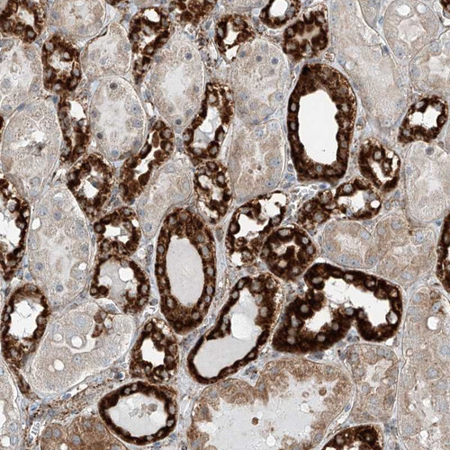 Immunohistochemical staining of human kidney shows strong granular cytoplasmic positivity in cells in tubules.