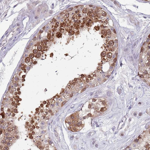 Immunohistochemical staining of human testis shows strong cytoplasmic positivity in cells in seminiferus ducts.