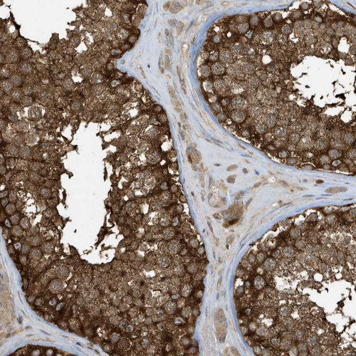 Immunohistochemical staining of human testis shows strong cytoplasmic positivity in cells of seminiferus ducts.