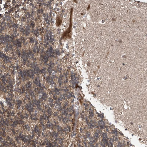 Immunohistochemical staining of human cerebellum shows distinct cytoplasmic positivity in Purkinje cells.