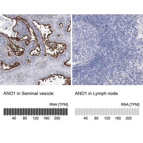 Immunohistochemistry analysis in human seminal vesicle and lymph node tissues using Anti-ANO1 antibody. Corresponding ANO1 RNA-seq data are presented for the same tissues.