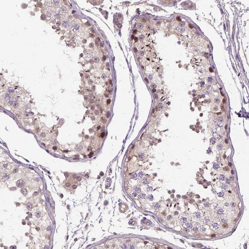 Immunohistochemical staining of human testis shows strong cytoplasmic positivity in spermatogonia.