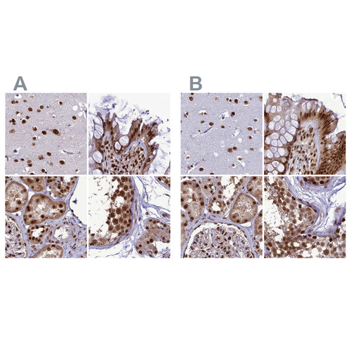 Immunohistochemical staining of human cerebral cortex, colon, kidney and testis using Anti-DDX1 antibody HPA034502 (A) shows similar protein distribution across tissues to independent antibody HPA034503 (B).