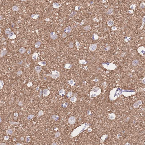 Immunohistochemical staining of human cerebral cortex shows distinct positivity in neuropil.