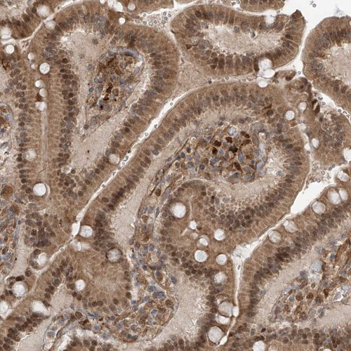 Immunohistochemical staining of human duodenum shows moderate cytoplasmic and nuclear positivity in glandular cells.