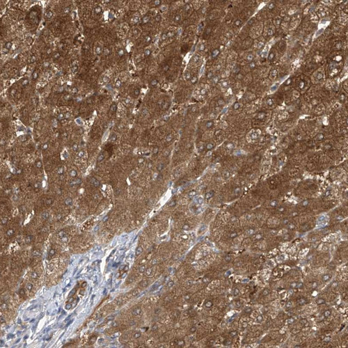 Immunohistochemical staining of human liver shows distinct cytoplasmic positivity in hepatocytes and bile duct cells.
