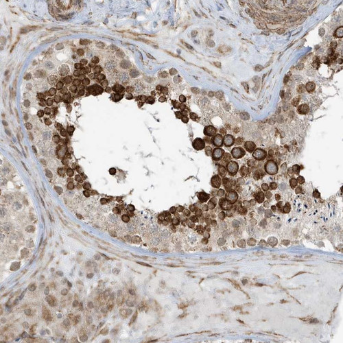 Immunohistochemical staining of human testis shows strong cytoplasmic positivity in cells in seminiferus ducts. 
