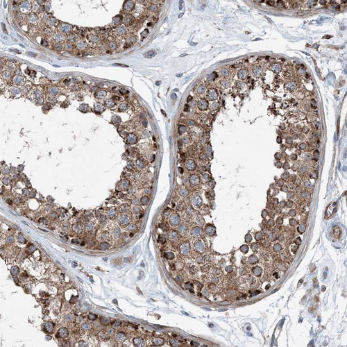 Immunohistochemical staining of human Testis shows strong granular cytoplasmic positivity in cells in seminiferous ducts.