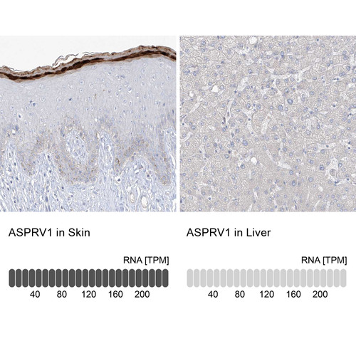 Immunohistochemistry analysis in human skin and liver tissues using HPA034810 antibody. Corresponding ASPRV1 RNA-seq data are presented for the same tissues.