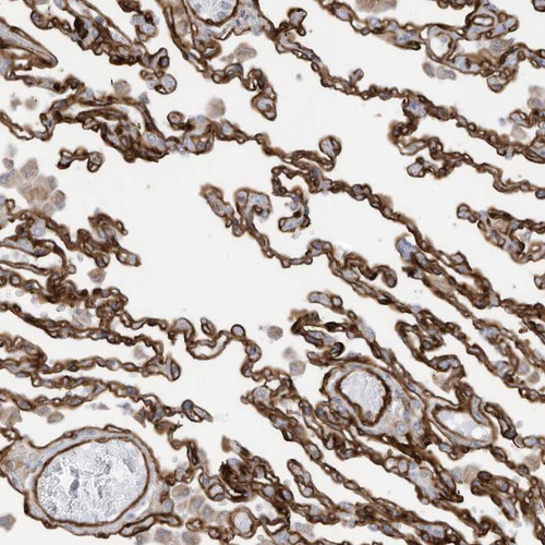 Immunohistochemical staining of human lung shows strong membranous positivity in alveolar cells.