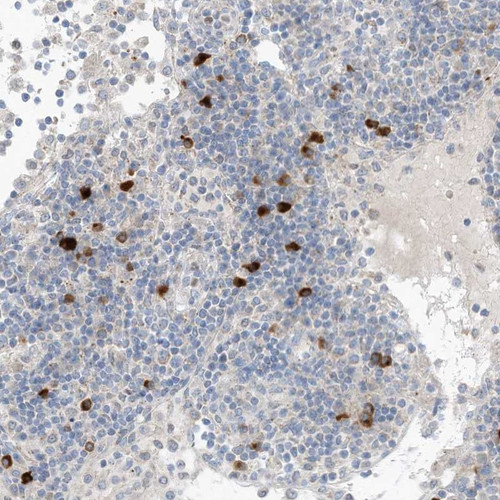 Immunohistochemical staining of human lymph node shows strong cytoplasmic positivity in subsets of lymphoid cells outside reaction centra.