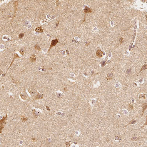Immunohistochemical staining of human cerebral cortex shows moderate cytoplasmic positivity in neurons.