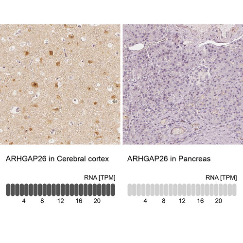 Immunohistochemistry analysis in human cerebral cortex and pancreas tissues using Anti-ARHGAP26 antibody. Corresponding ARHGAP26 RNA-seq data are presented for the same tissues.