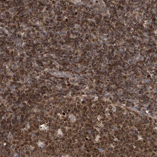 Immunohistochemical staining of human appendix shows strong cytoplasmic and nuclear positivity in glandular cells.
