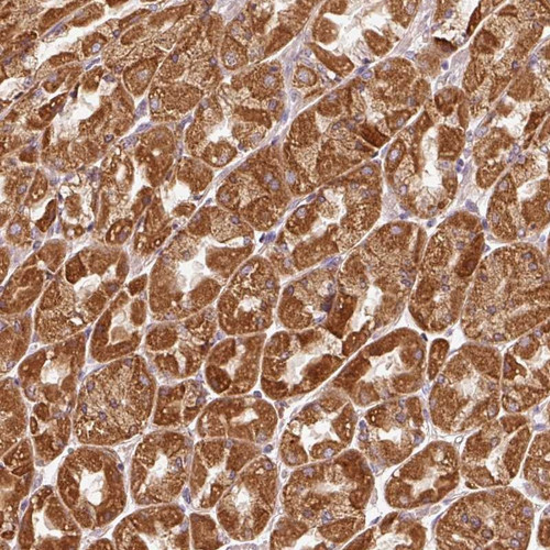 Immunohistochemical staining of human stomach, upper shows strong cytoplasmic positivity in glandular cells.