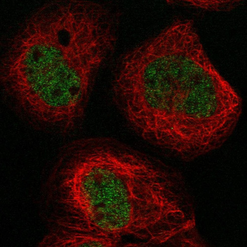 Immunofluorescent staining of human cell line A-431 shows localization to nucleoplasm.