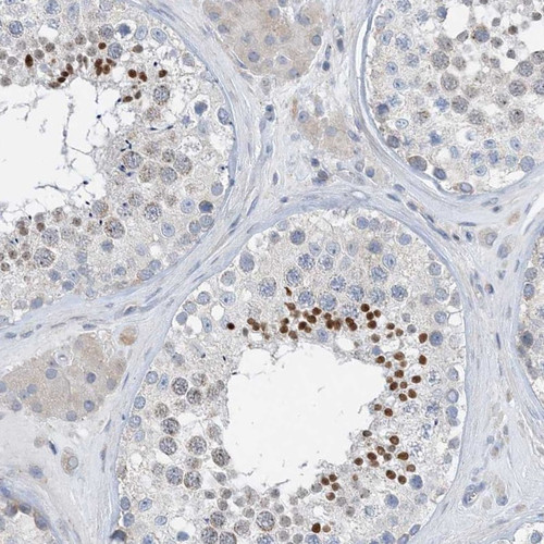 Immunohistochemical staining of human testis shows nuclear positivity in cells in seminiferous ducts.