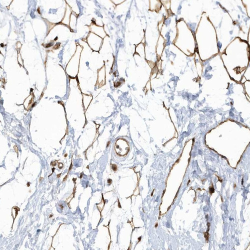 Immunohistochemical staining of human breast shows strong cytoplasmic positivity in adipocytes.